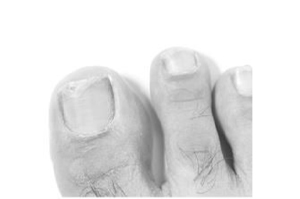 TERBINAFIN-1A Pharma Nagelll.g.Nagelpilz 78,22mg/ml, 6.6 ml