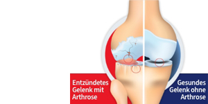 GELENCIUM Mélange arthro, 2X100 ml
