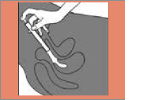 CLOTRIMAZOL AL Crème vaginale 2%, 20 g