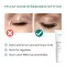 BENEVI Crème neutre pour les paupières, 15 ml