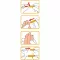 WELLION Safetylancets 28 G Hall de sécurité, 25 pièces