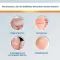 Solution EndWarts® CLASSIC , 3 ml